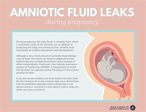 Leaking Amniotic Fluid: Signs, Causes, and。